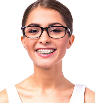 Clear Braces