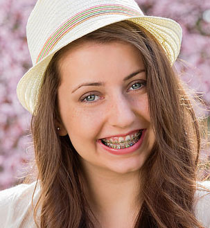 Metal Braces